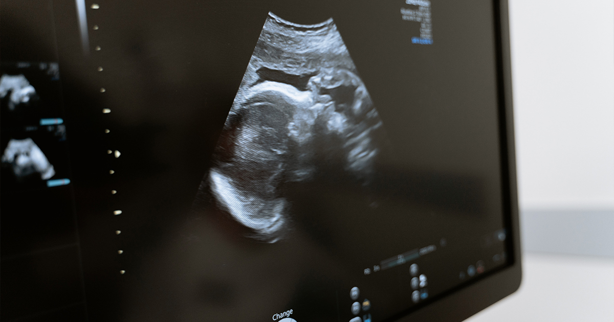 The South Carolina Supreme Court Strikes Down the State’s Fetal Heartbeat Act