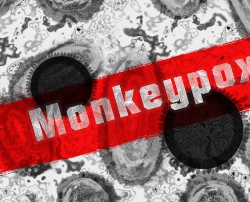 Monkeypox