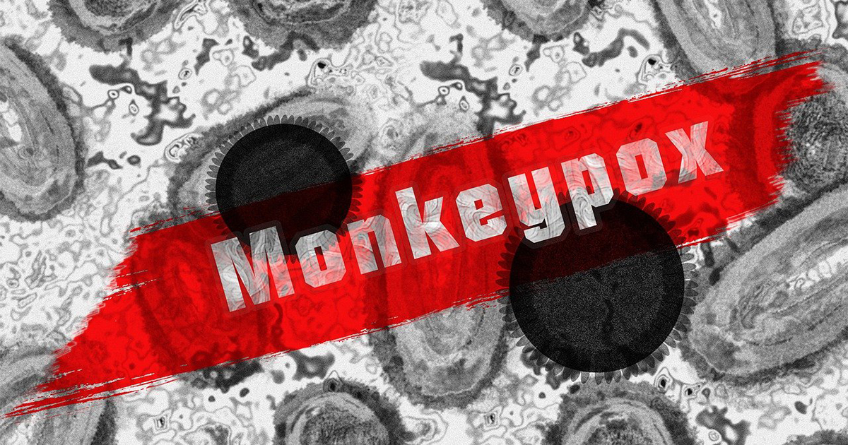 WHO: Monkeypox Can Be Contained If We Act Now