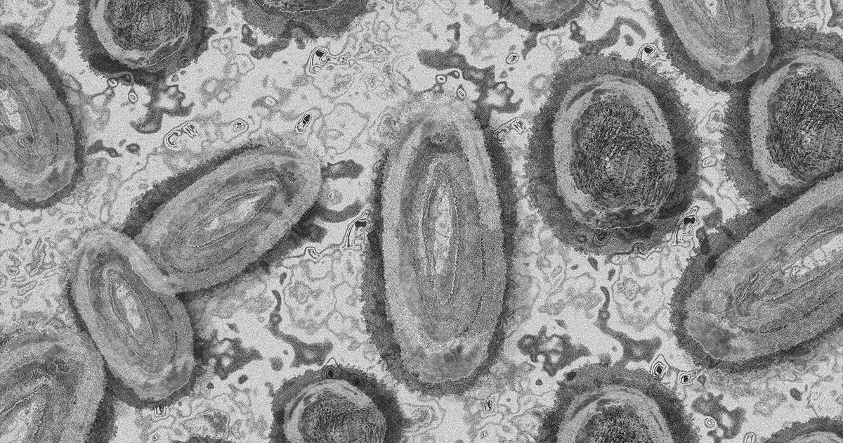 Canada Issues Monkeypox Travel Notice